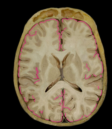 <p>The hills “The fold or convolution of cerebral cortex”</p>