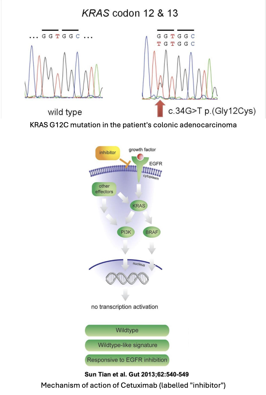 <p>What is your conclusion about whether cetuximab would be a suitable treatment?</p>