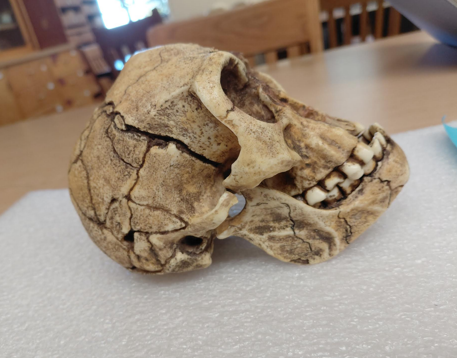 <p>Homo floresiensis!</p><p></p><p>Distinguishing Features:</p><ul><li><p>Has all Homo traits, but smaller!</p></li><li><p>Receding forehead</p></li><li><p>No chin</p></li></ul><p></p>
