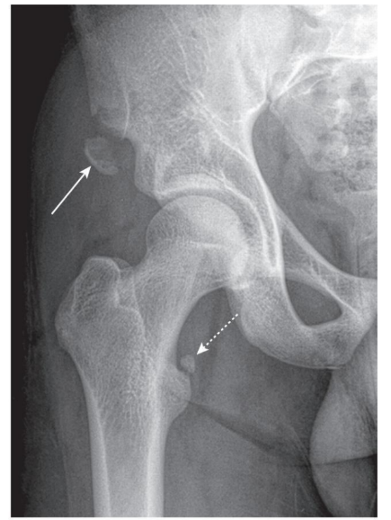 <p>diagnosis</p>