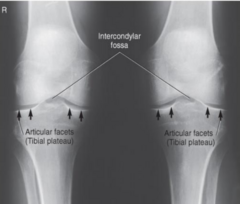 <p>Weightbearing Knees - AP Projection X-ray Diagram</p>