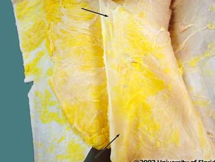 <p>what layer of fascia are the arrows pointing to</p>