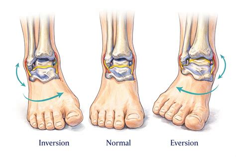 <p><strong>Inversion</strong> of the foot is a movement which involves tilting of the foot such that the sole of the foot faces medially or inwards. The movement occurs at the intertarsal and tarsometatarsal joints and NOT at the ankle joint.</p><p>The opposite of <strong>inversion</strong> is eversion, where the sole of the foot faces outwards or laterally.</p>