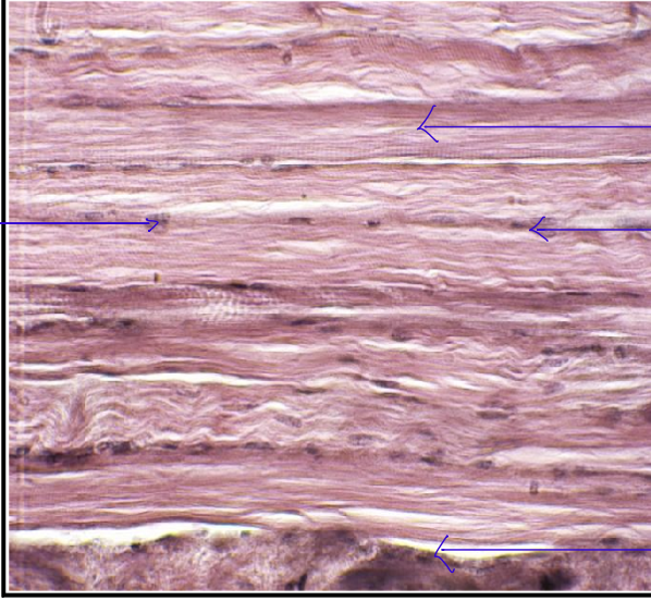 <p><span>What is/are the structure/s visible in HPO which is/are barely recognizable in LPO?</span></p>