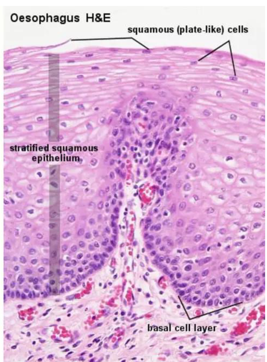 <p>Examples:</p><p>• Esophagus</p><p>• Oral cavity (buccal lining, inside of the lips, soft</p><p>palate, floor of the mouth, some parts of the tongue)</p><p>• Cornea</p><p>• Vagina</p><p>• Anus</p>