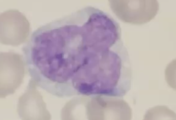 <p>monoblast - blue gray cytoplasm </p>