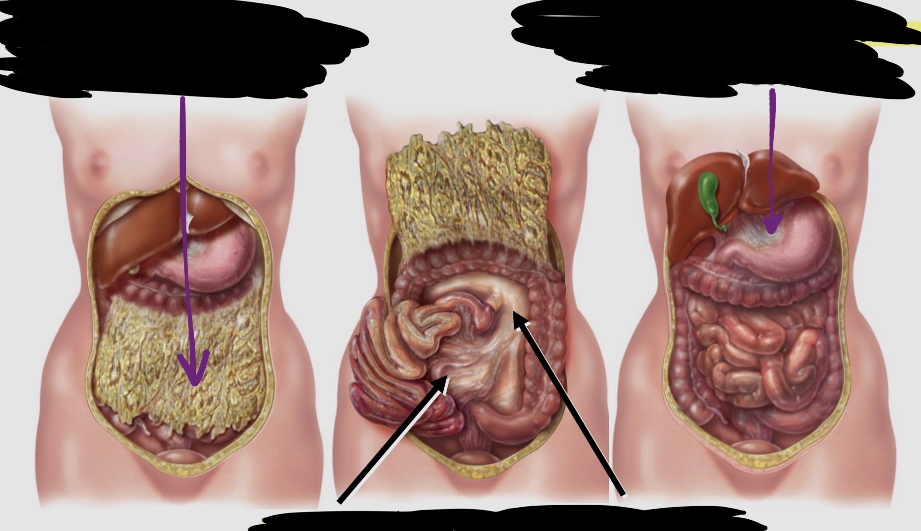 <p>Types of Peritoneum Folds &amp; function (Part 2)</p>