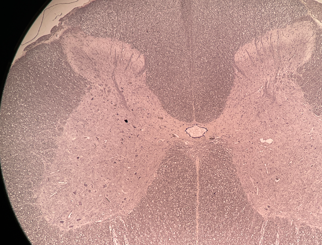 <p>Identify the region of the spinal cord this cross section is from.</p>