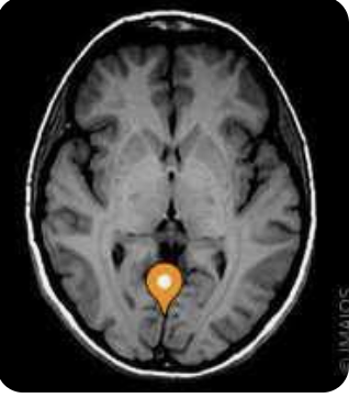<p>Name the sulcus, modality, and plane</p>