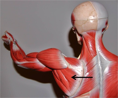 <p>What muscle is this?</p>