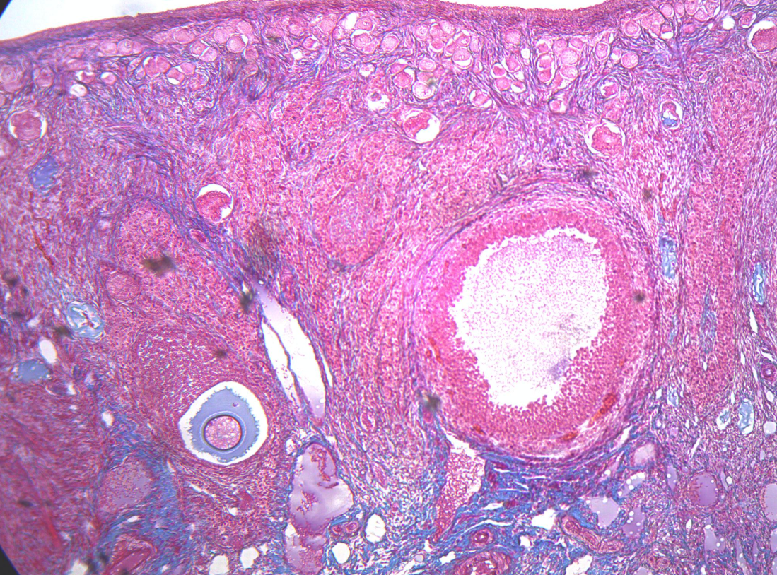 <p>What part of the body is seen in this image?</p>