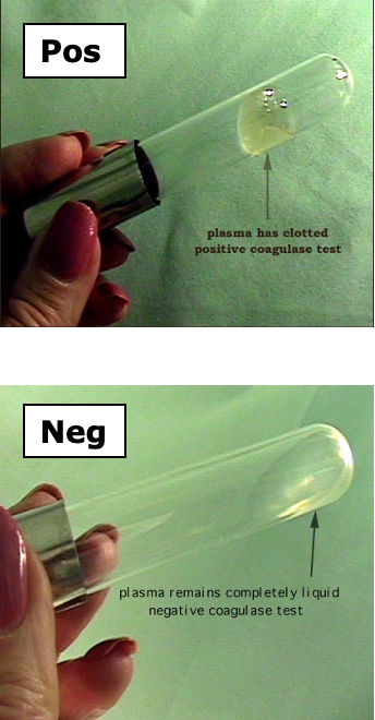 <p>Tube test: detects free coagulase (stphylocoagulase)</p><p>-extracellular enzyme</p><p>-reacts with thrombin-like molecule in plasma</p><p>-converts fibrinogen to fibrin</p>