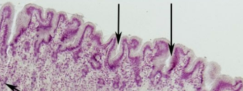 <p>what are black arrows pointing to (stomach)</p>