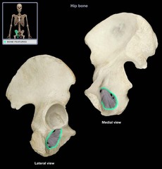 <p>Round or oval opening/hole through a bone</p><p>ex: obturator___ in pelvis</p>