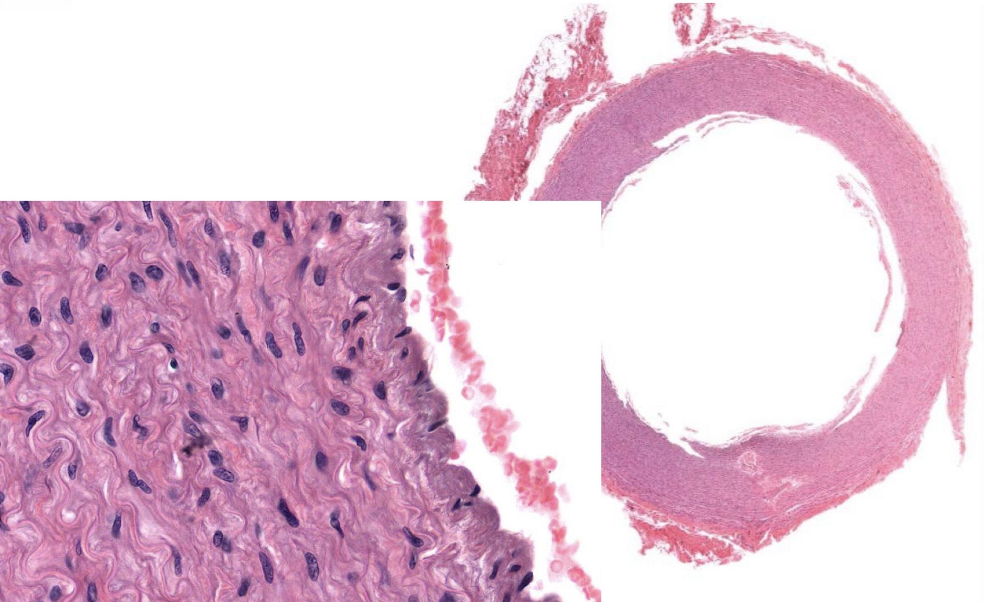 <p>Identify the Vessel and the Layer pictured</p>