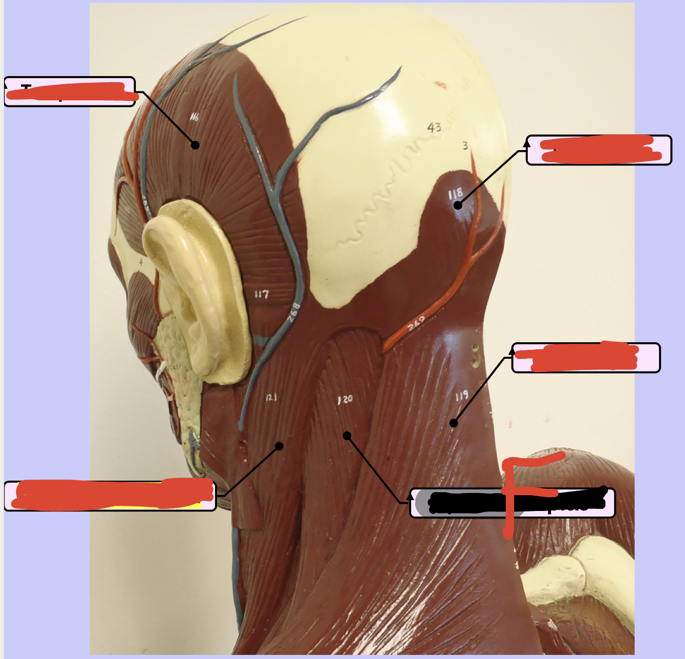 <p>Middle center - Side of head — F</p>