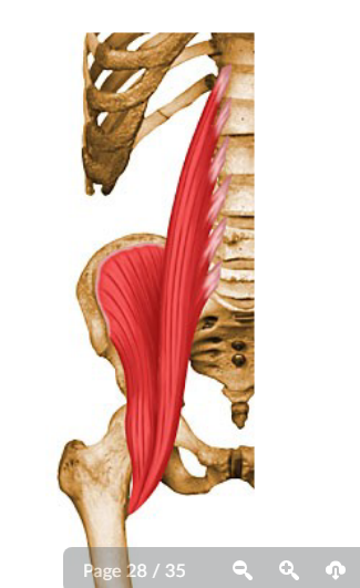 <p>What muscle is this? <br>Name. Origin, Insertion, Action, Exercise </p>
