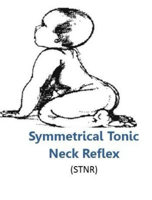 <p></p><ul><li><p><em>The arms follow the movement of the head, while the legs are opposite</em>&nbsp;</p></li><li><p>Example:</p><ul><li><p>Head flexes</p></li><li><p>Arms flex</p></li><li><p>Legs extend</p></li></ul></li></ul><p></p>