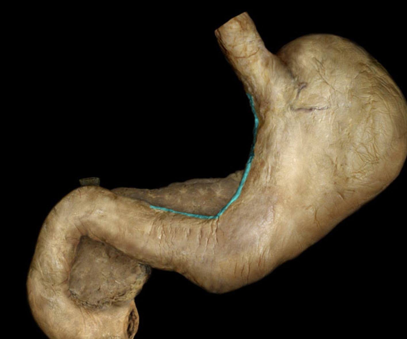 term image