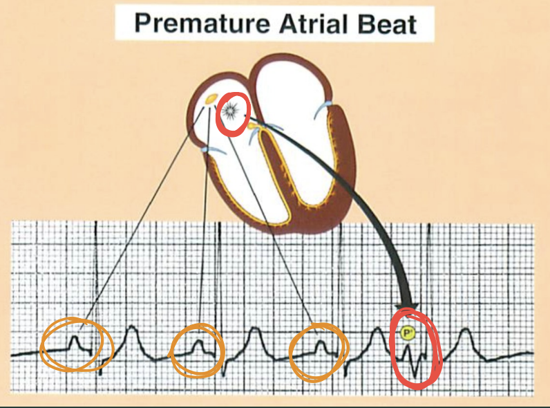 <p>What makes this a PAB?</p>