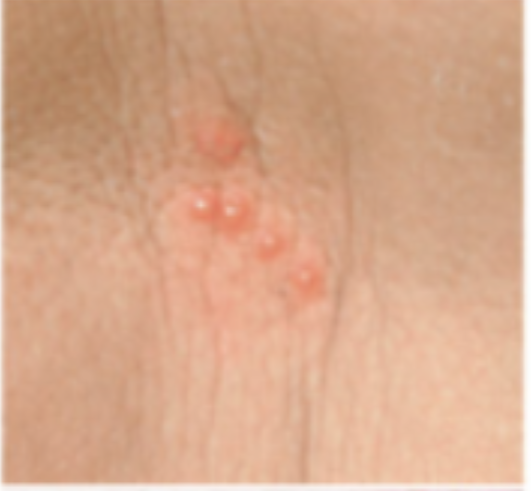 term image