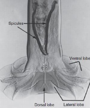 <p><span style="color: blue;">Describe the Spicules of Male Strongyloids and Ancylostomatoids</span></p>