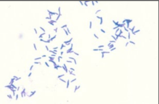<ul><li><p>Gram +</p></li><li><p>Cocci, club or rods (pleomorphic) → “Chinese Characters”</p></li><li><p>Non-spore forming</p></li><li><p>Non-motile</p></li><li><p>Facultative anaerobe</p></li></ul><p></p>