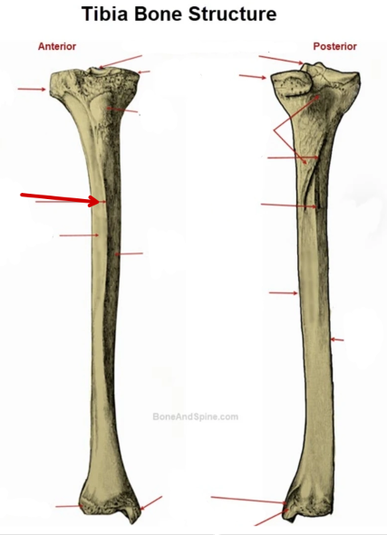 <p>Tibia</p>