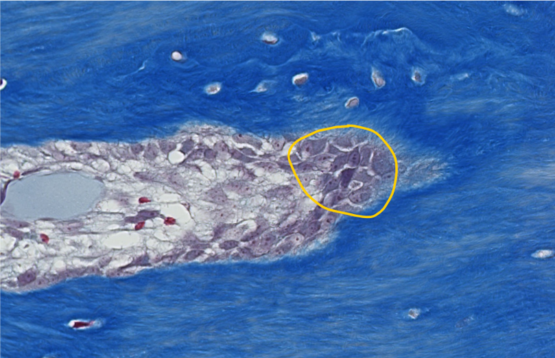 <p><span style="font-family: "Calibri Light";">1. ID the encircled bone cells.<br><br>2. What CT layer are these cells located within?</span></p>