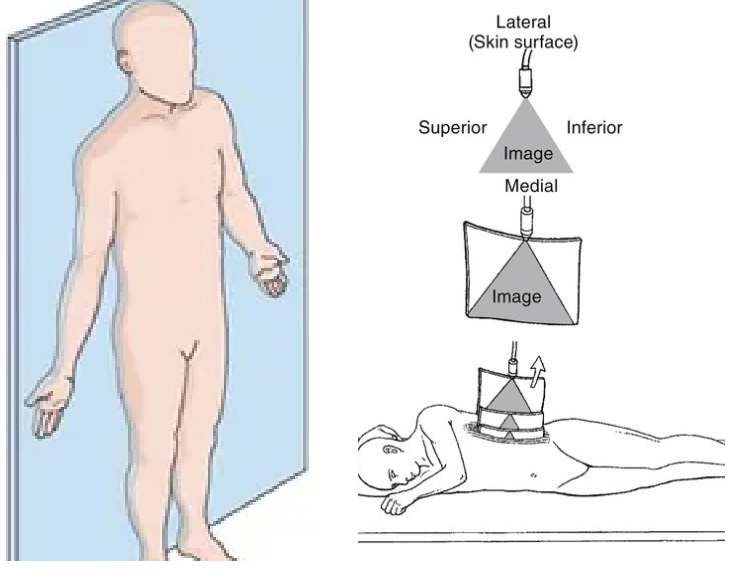 <p>Divides body anterior to posterior</p>