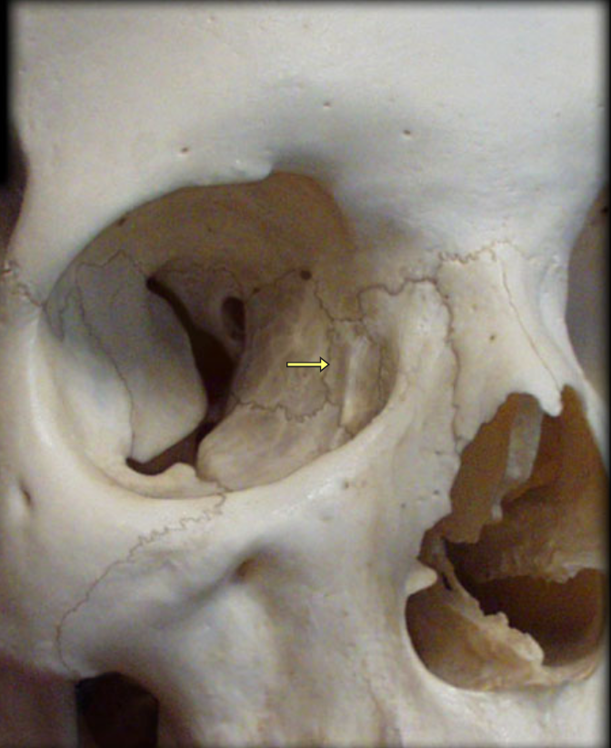 term image