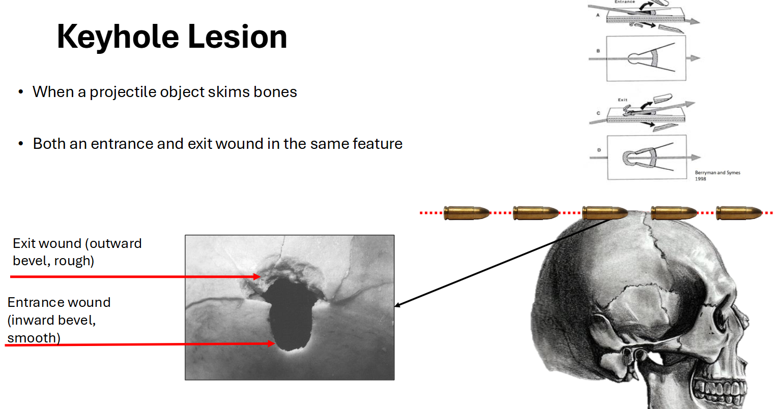 <p>Keyhole Lesion</p>
