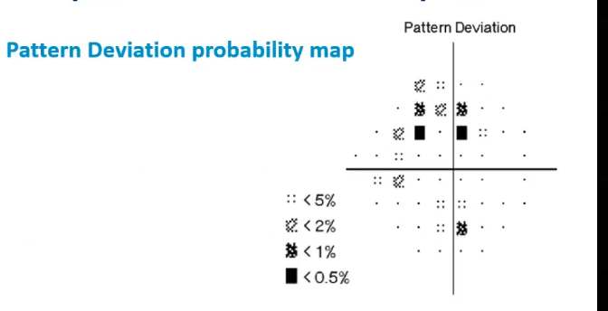 <p>interp VF plot: pattern deviation probability map </p>