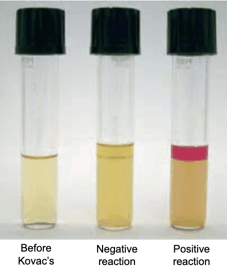 <p><u>Left:</u> SIM Agar without Kovac’s Reagent</p><p><u>Middle:</u> SIM Agar with Kovac’s Reagent showing a negative reaction, meaning there was no Indole production</p><p><u>Right:</u> SIM Agar with Kovac’s Reagent showing a positive reaction, meaning there was indole production</p>