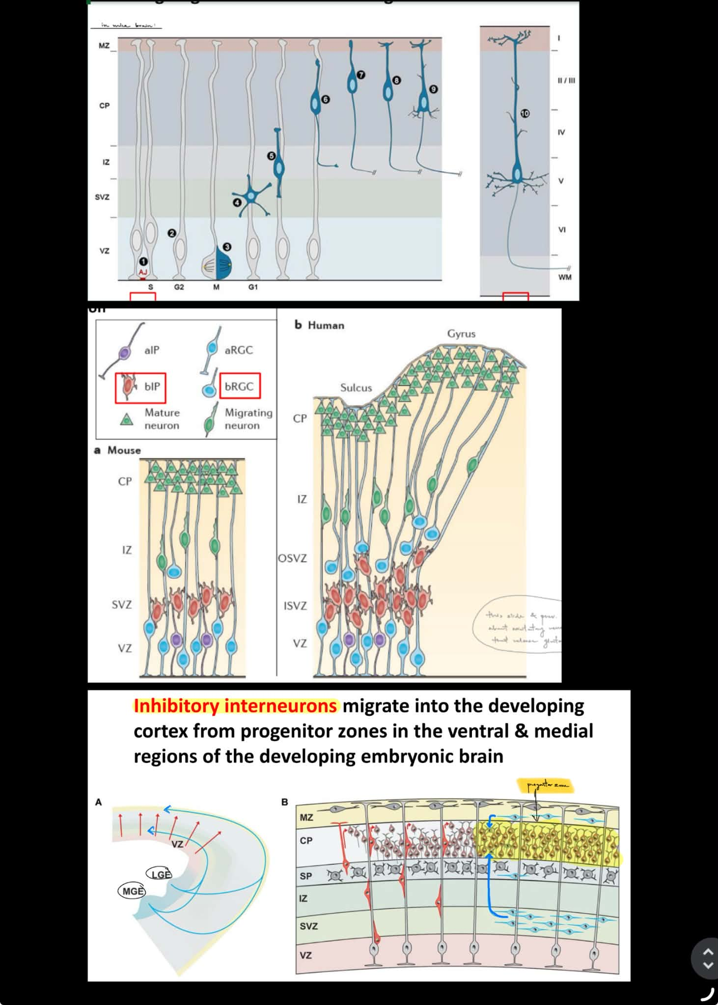 <p>true</p><ul><li><p>Reelin gene mutations will cause disorganization of migrating neurons</p></li></ul><p>during migration, neurons also begin to develop <u>axons</u></p><p>__</p><p><strong>primate </strong>brains have subtypes of neural progenitors called<strong> <u>intermediate progenitors (IPs)</u></strong> &amp; <strong><u>basal radial glial cells (bRGCs)</u></strong>, which will <u>form a new zone of proliferation</u> <span style="color: rgb(168, 167, 167);">(aka new area/layer of proliferation)</span></p><p><strong><u>inhibitory interneurons</u></strong> will also migrate from the <strong><u>progenitor zones</u></strong> in the <u>ventral</u> &amp; <u>medial</u> regions of developing embryonic brain INTO the developing cortex </p><p>^^</p><p><span style="color: purple;">progenitor zones are where neural progenitors aka neural stem cells are located</span></p><p><span style="color: purple;">developing cortex (is area w/ lots of neurons)</span></p>