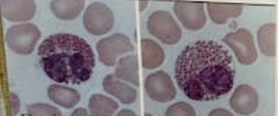 <p>What white blood cell is this</p>