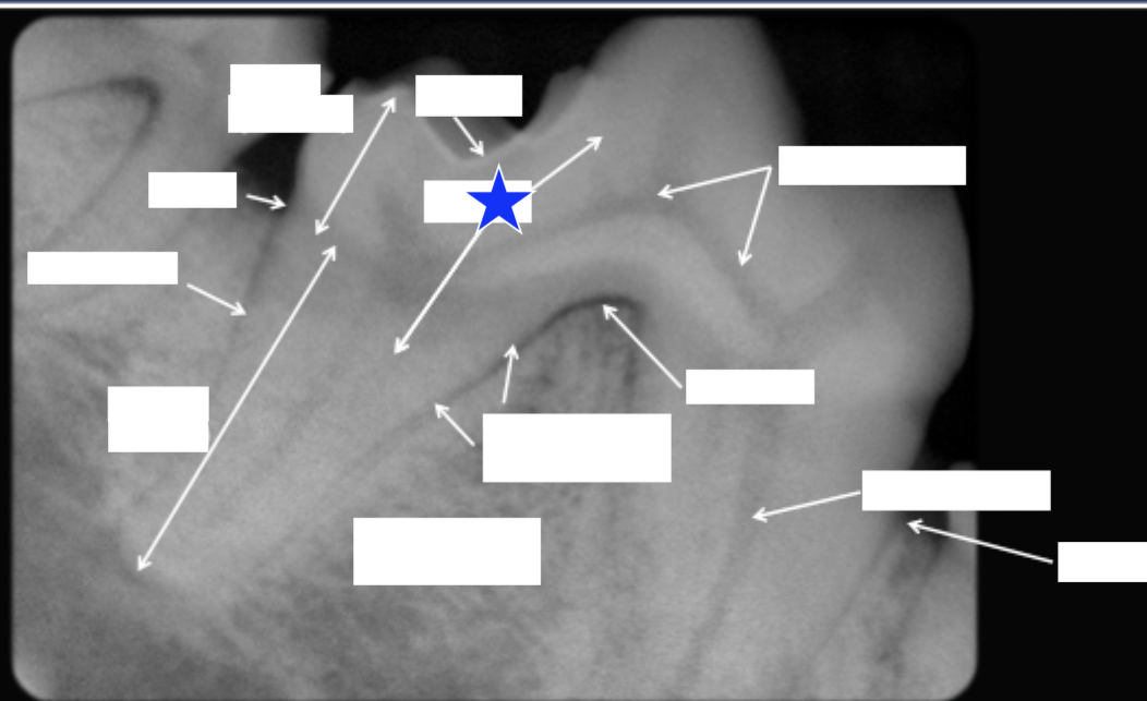 <p>What part of the tooth is indicated by the star (both arrows)?</p>