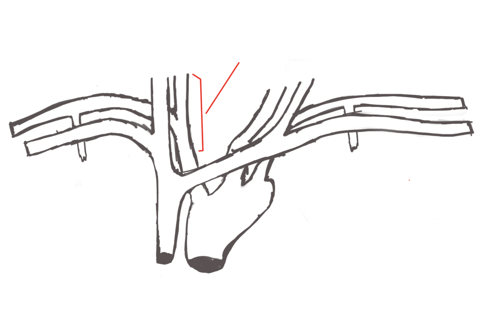 <p>structure. Top of brachiocephalic artery</p>