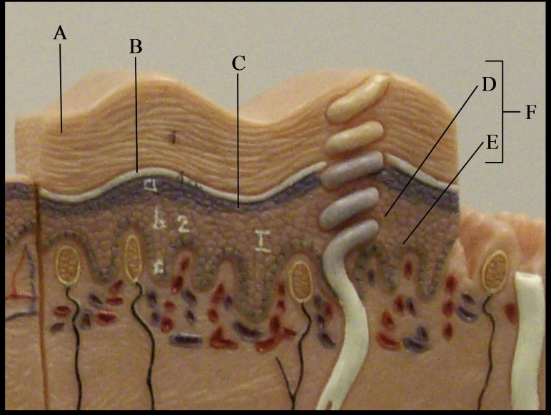 term image