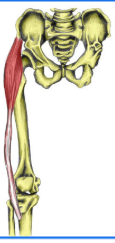 <p><span style="background-color: transparent;">A: flexion &amp; medial rotation hip</span></p>