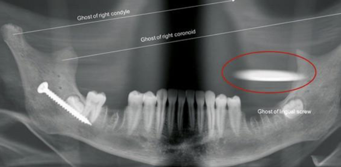 <p>what is shown in the red circle </p>