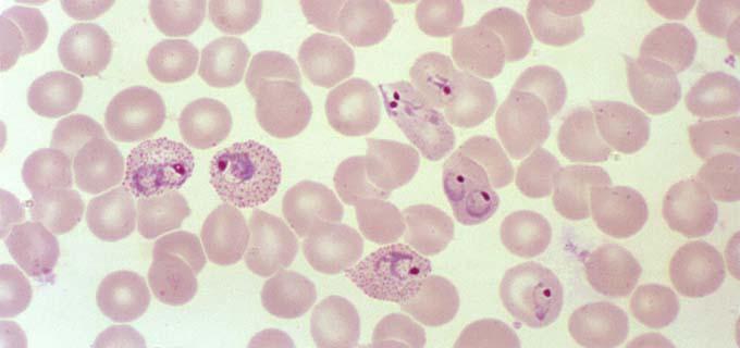 <ul><li><p>usually invades <u>reticulocytes</u></p></li><li><p><u>enlarged</u>, infected RBCs</p></li><li><p><strong><u>Schuffner’s stippling</u></strong> may be present (fine pink dots)</p></li></ul><p></p>