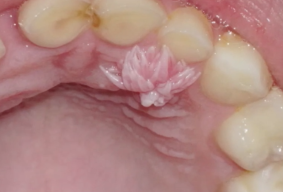 <p>what is the management?</p>