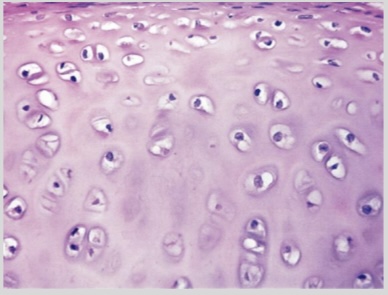<p>NTK: what type of cartilage is this </p>