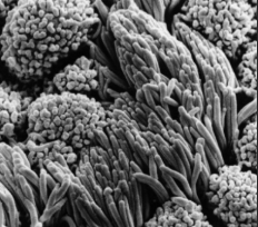 <p>what kind of epithelium is shown?</p>