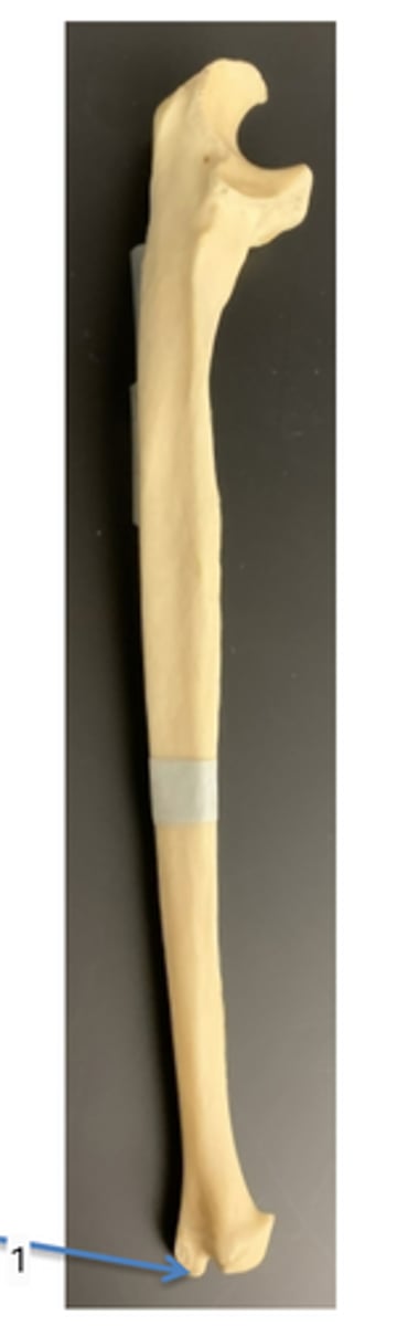 <p>bone and class?</p>