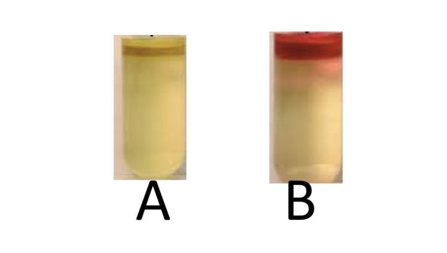 <p>Tryptophan Hydrolysis/Indole</p><p>a) Medium?</p><p>b) Substrate?</p><p>c) Enzyme?</p><p>d) Indicator/Reagent?</p><p>e) End Product?</p>
