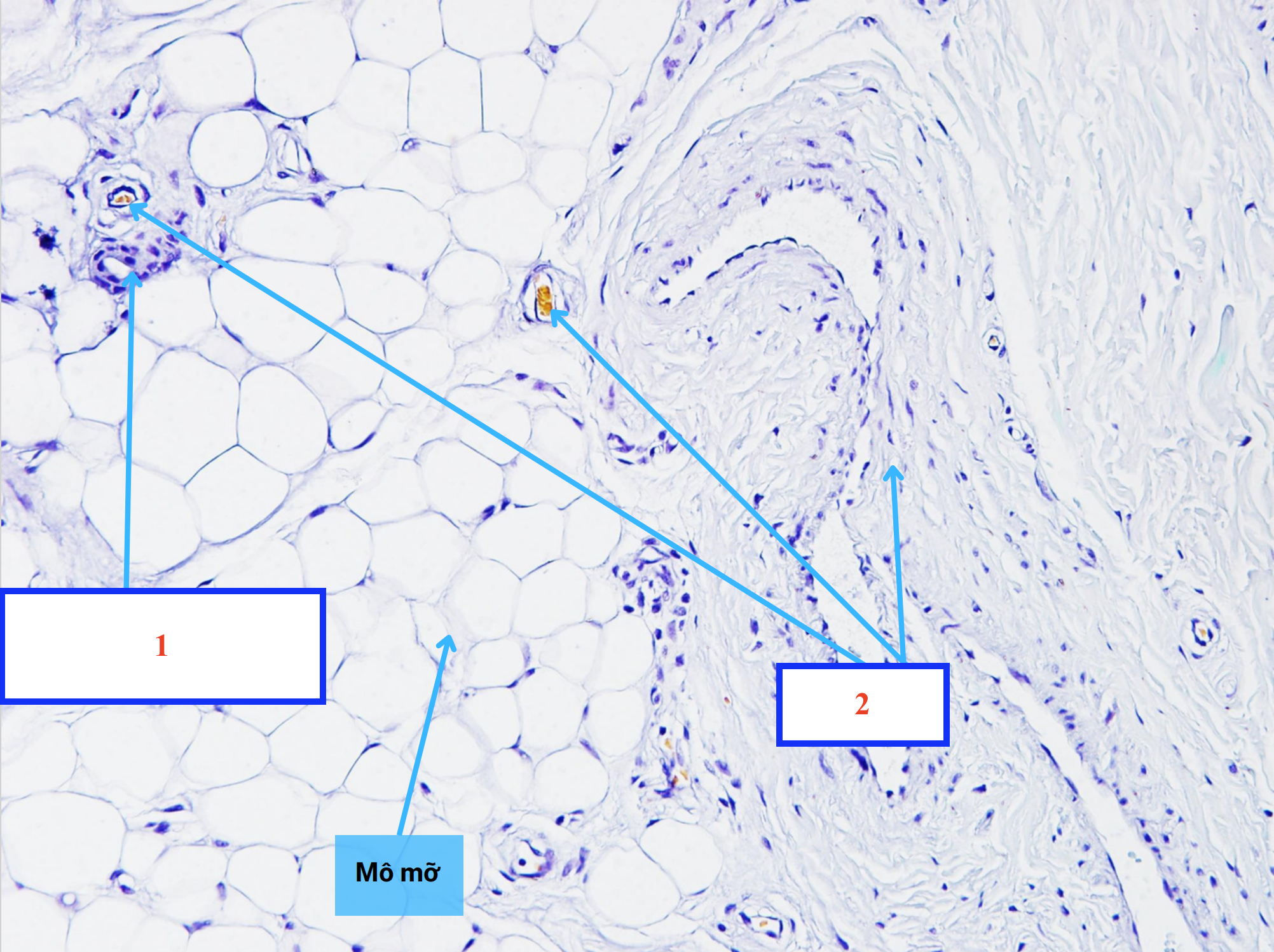 <p>Cấu trúc gì ? - Biểu mô gì ?</p>