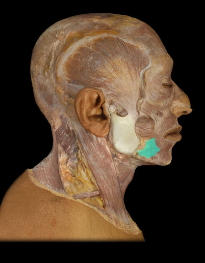 <p>Depressor anguli oris m.</p>