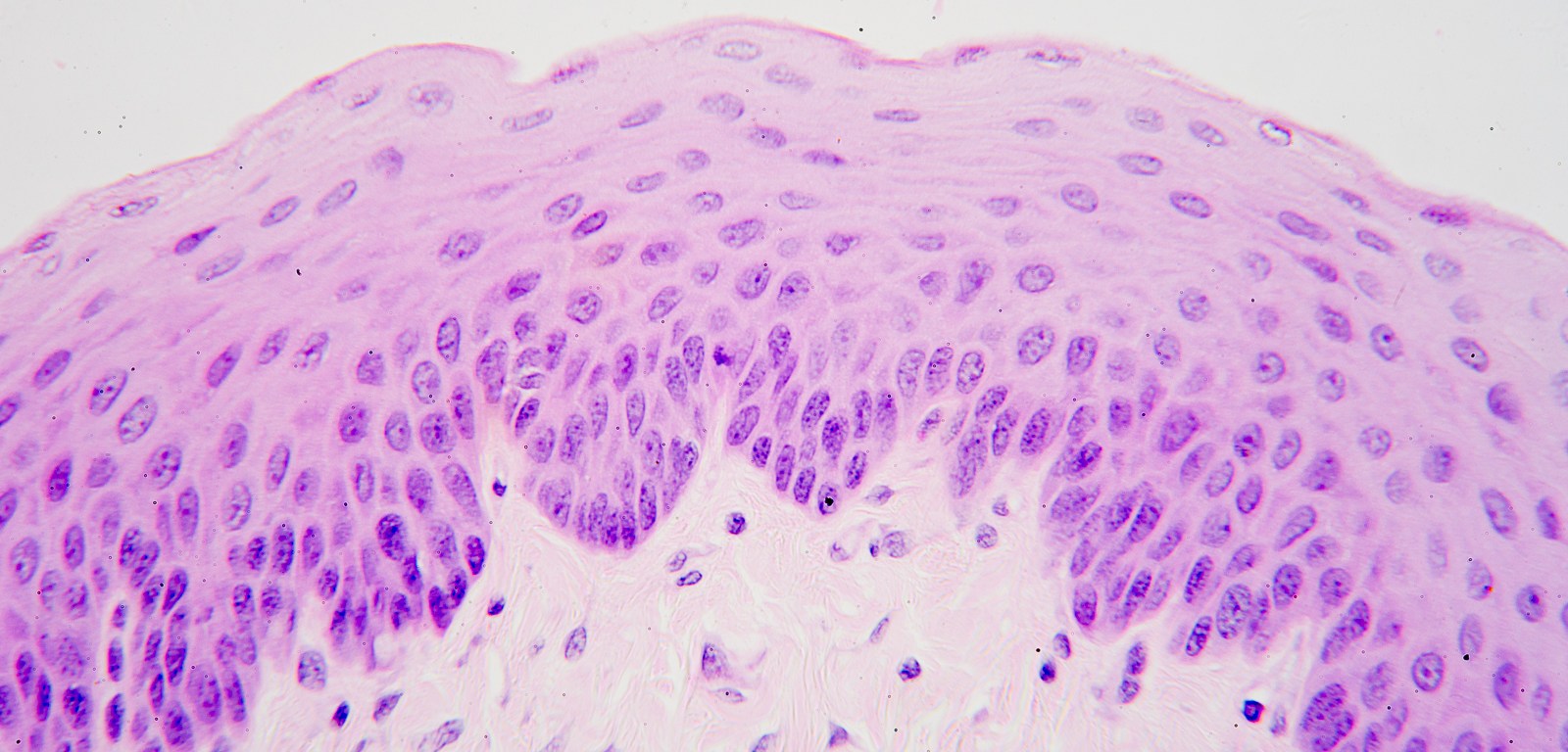 <p>Stratified Squamous</p>